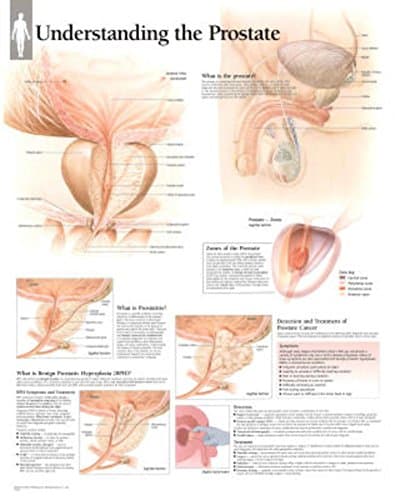 Understanding the Prostate Educational Chart Poster 22 x 28in with Poster Hanger