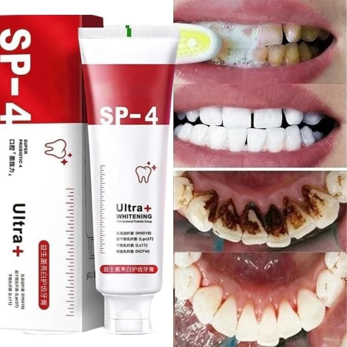 SP 4 Ultra Whitening Toothpaste, Teeth Cleaner, Advanced Whitening Formula for Stain Removal - (50gm Pack Of 1)