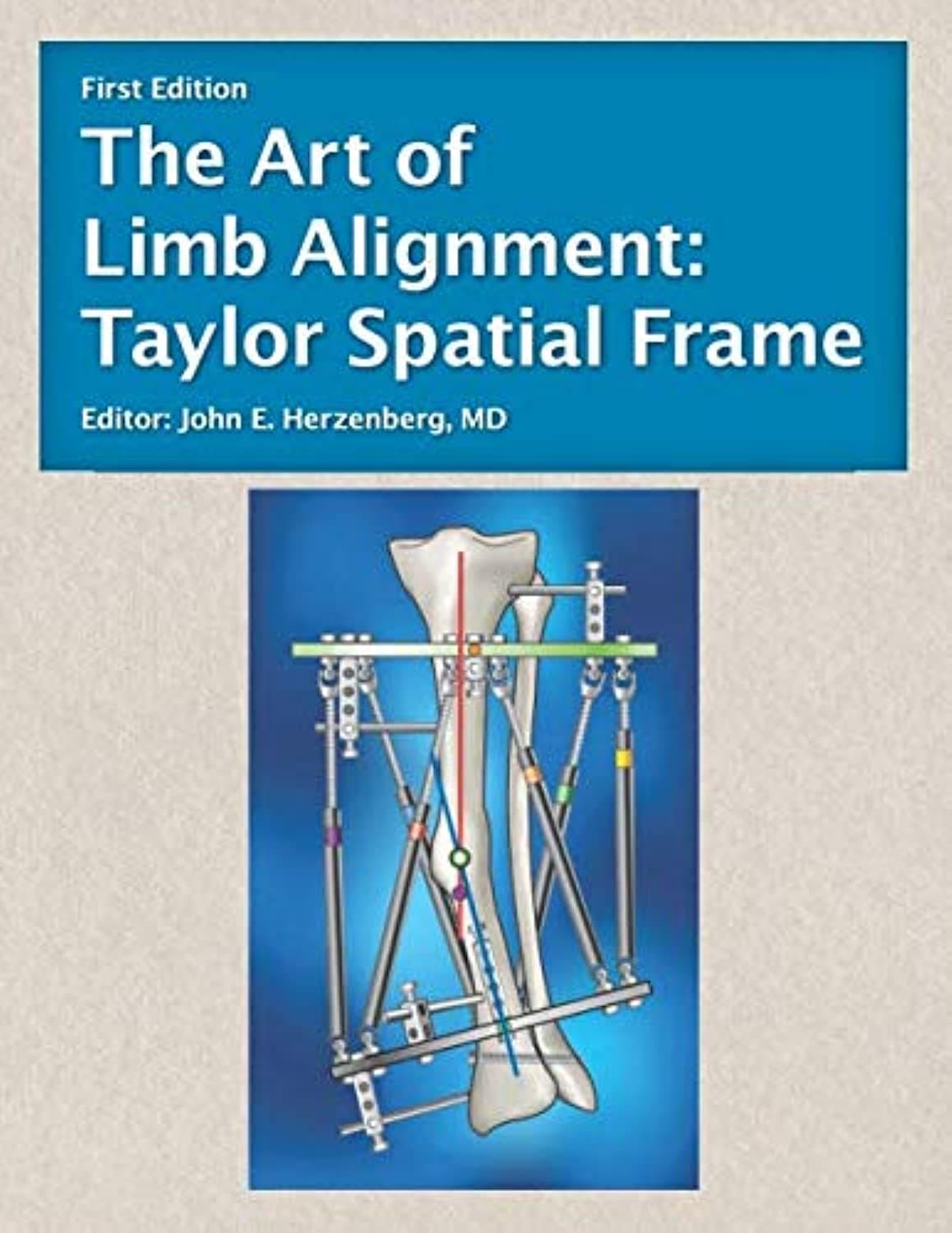 The Art of Limb Alignment: Taylor Spatial Frame Paperback – 21 June 2019