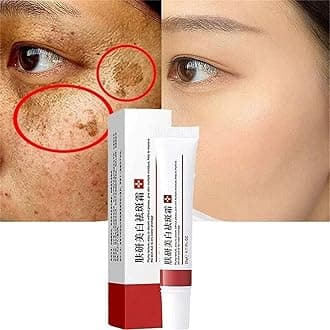 Whitening Freckle Cream,Acne Scar Removal Treatment Cream,Pigmentation Removal Cream for Face,Remove Dark Spots,Moisturizing Removes Facial Melasma Dark Spots Wrinkles Blemishes (2pcs)